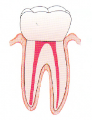 Root Canal Complete-471 Root Canal Complete-471